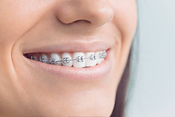 Best Laser Dentistry  in Pierre Part, LA
